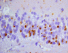 Frontotemporal lobar degeneration, ubiquitin immunoreactivity within dentate gyrus of hippocampus.