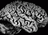 Frontotemporal lobar degeneration, lateral surface of brain