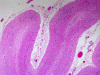 Cerebellar degeneration, H&E stained section x 20