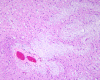 Amygdala, H&E stained section