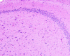 Hippocampal endplate, H&E stained section