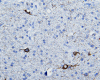 White Matter Neurons, neurofilament immunohistochemical stain