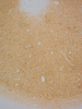 Prion IHC cerebrum