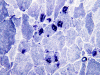 NADH stain: Tubular aggregates x400