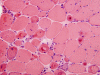 Ring fibers, H&E stain section