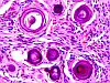 Basic Neuropathologic Reactions 5